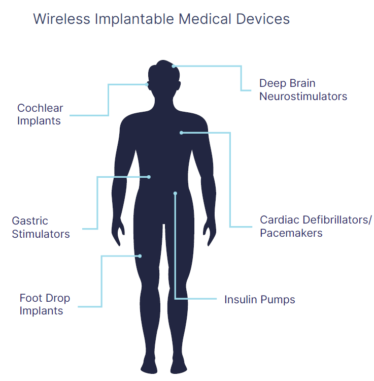 Wireless medical devices implanted in the body are becoming increasingly common in healthcare, posing a potential threat of exposure.