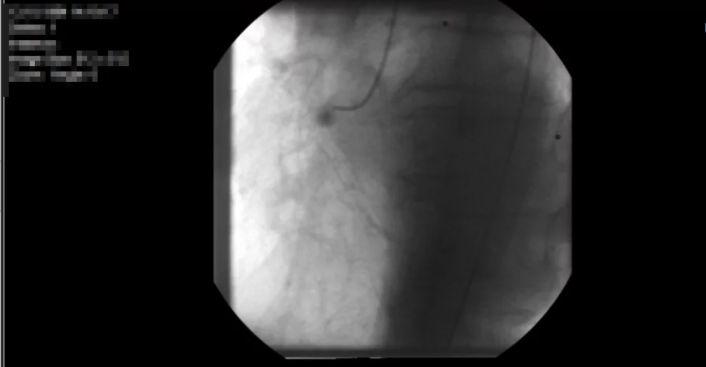 Figure 4: Example MR Image on MicroDicom